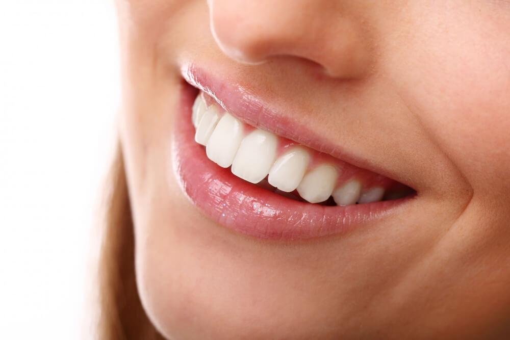 Invisalign