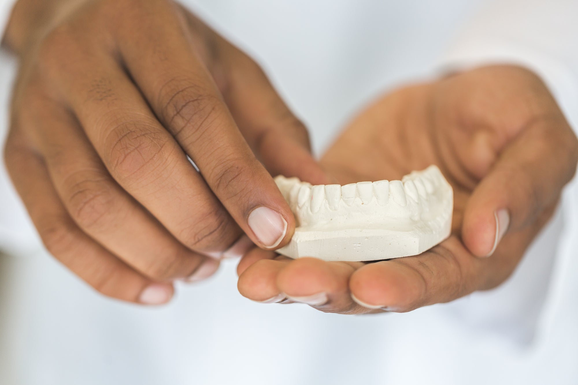 Dental Casting