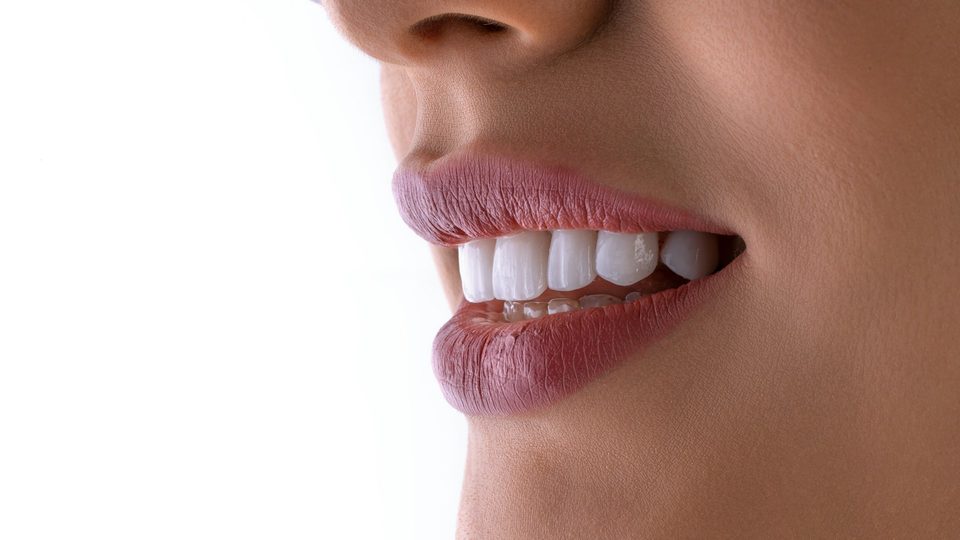 A close-up of a bright white smile after whitening