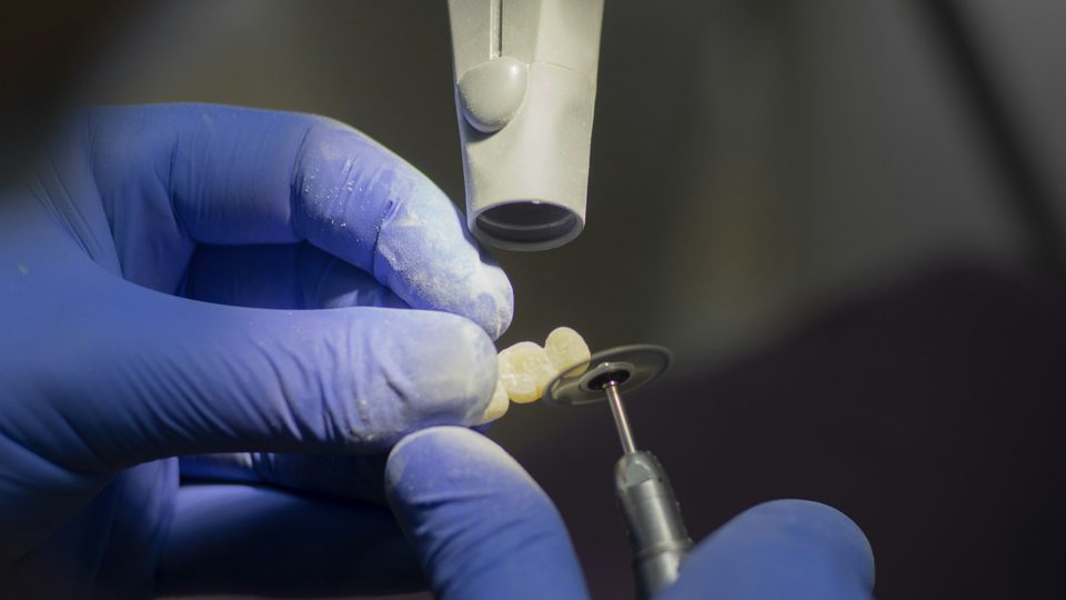 Extraction forceps held ready for a tooth removal